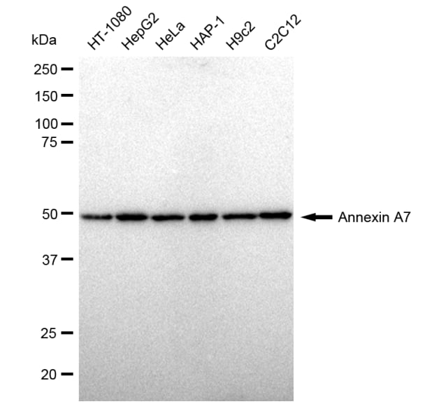 Annexin A7 Antibody (23GB1895)
