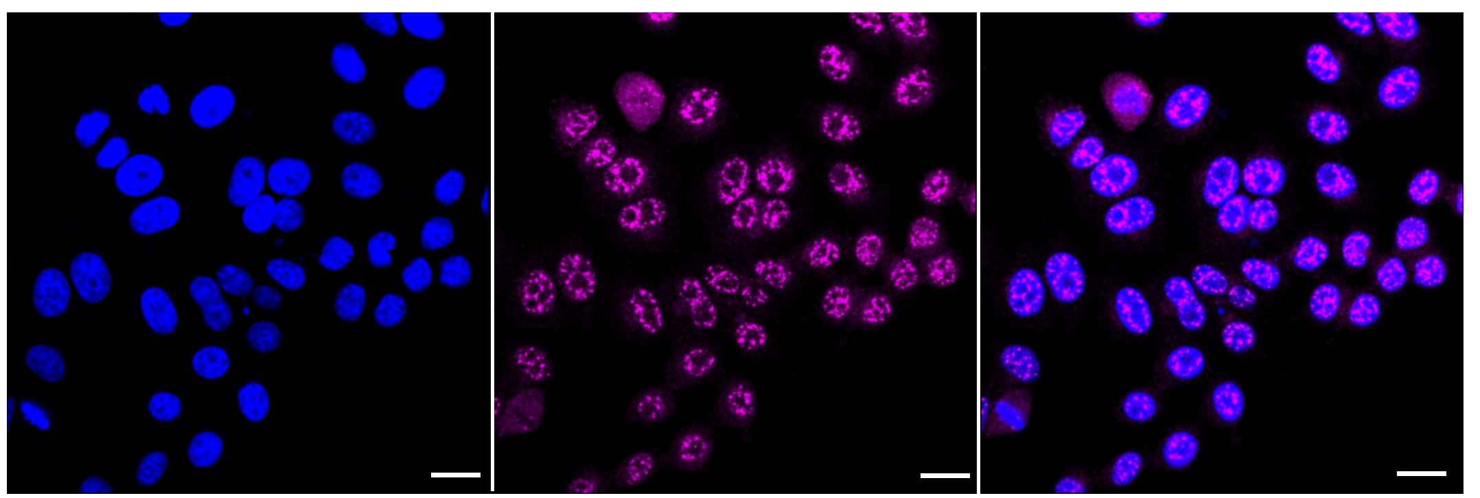 Calretinin Antibody (23GB1125)