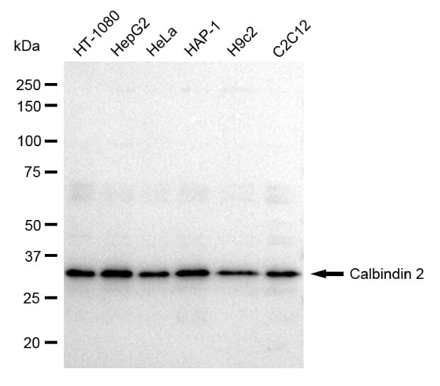 Calretinin Antibody (23GB1125)