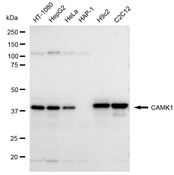 CaM Kinase I Antibody (23GB1290)