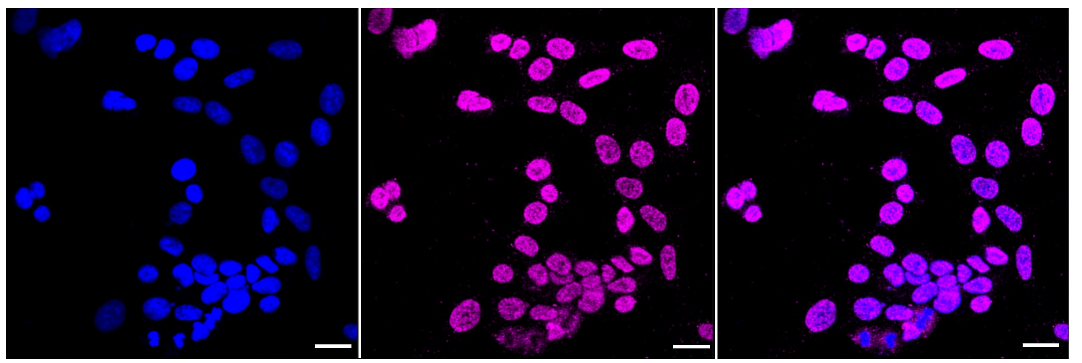 Sirtuin 1/SIRT1 [p Ser47] Antibody (23GB1540)