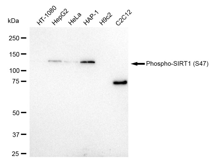 Sirtuin 1/SIRT1 [p Ser47] Antibody (23GB1540)