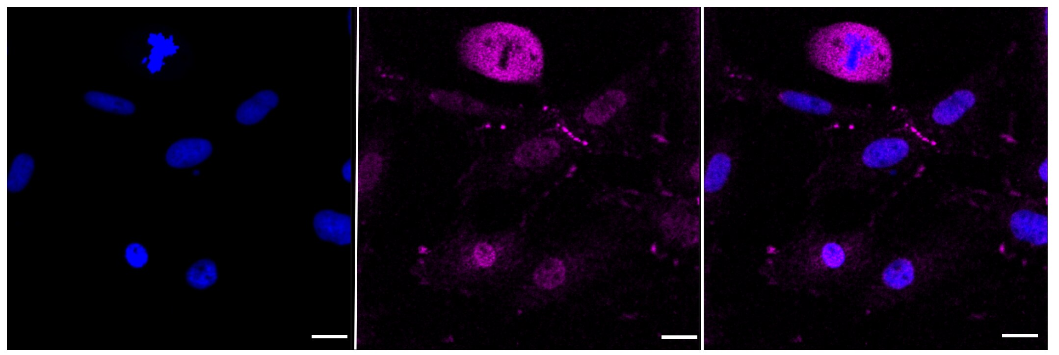 MDR1/ABCB1 Antibody (23GB1330)