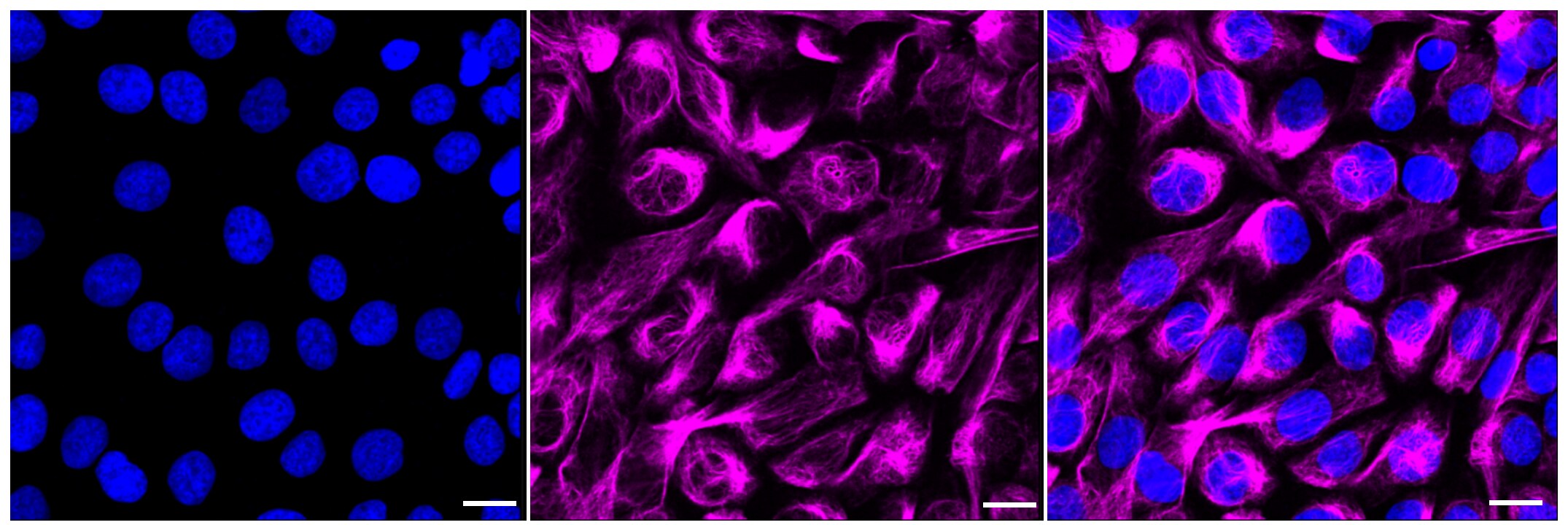 Centaurin beta 2 Antibody (23GB1565)