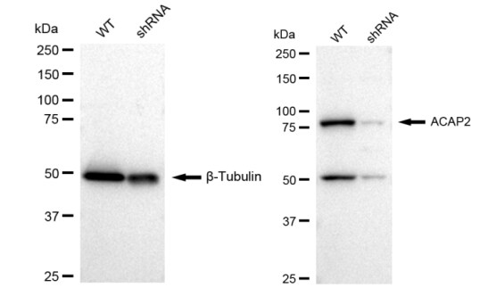 Centaurin beta 2 Antibody (23GB1565)
