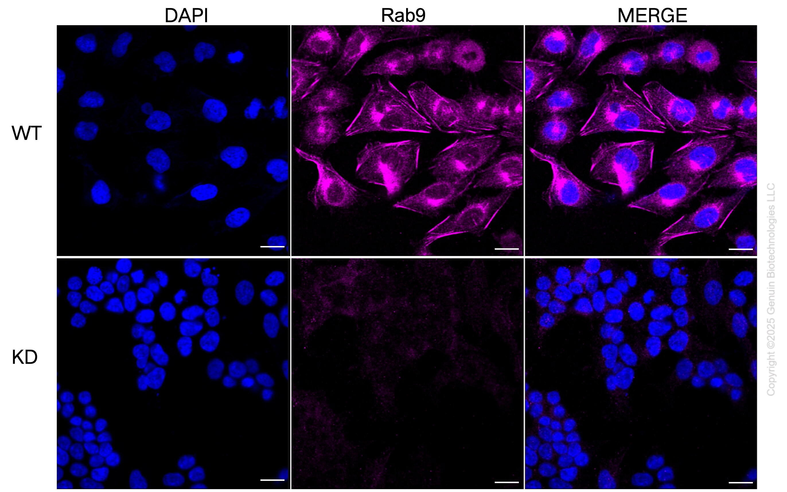 RAB9A Antibody (23GB1940)