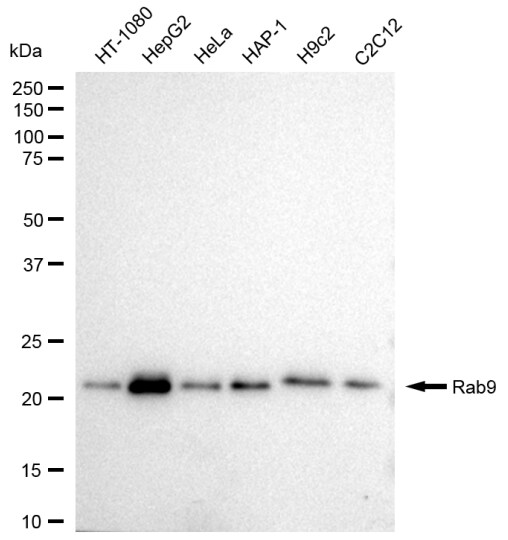 RAB9A Antibody (23GB1940)