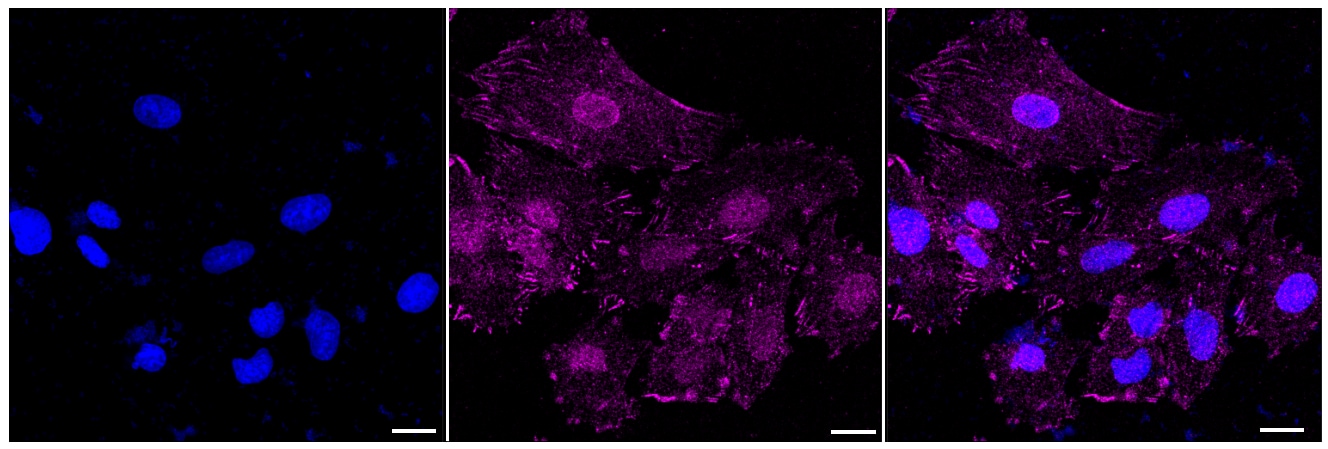 Destrin Antibody (24GB5920)