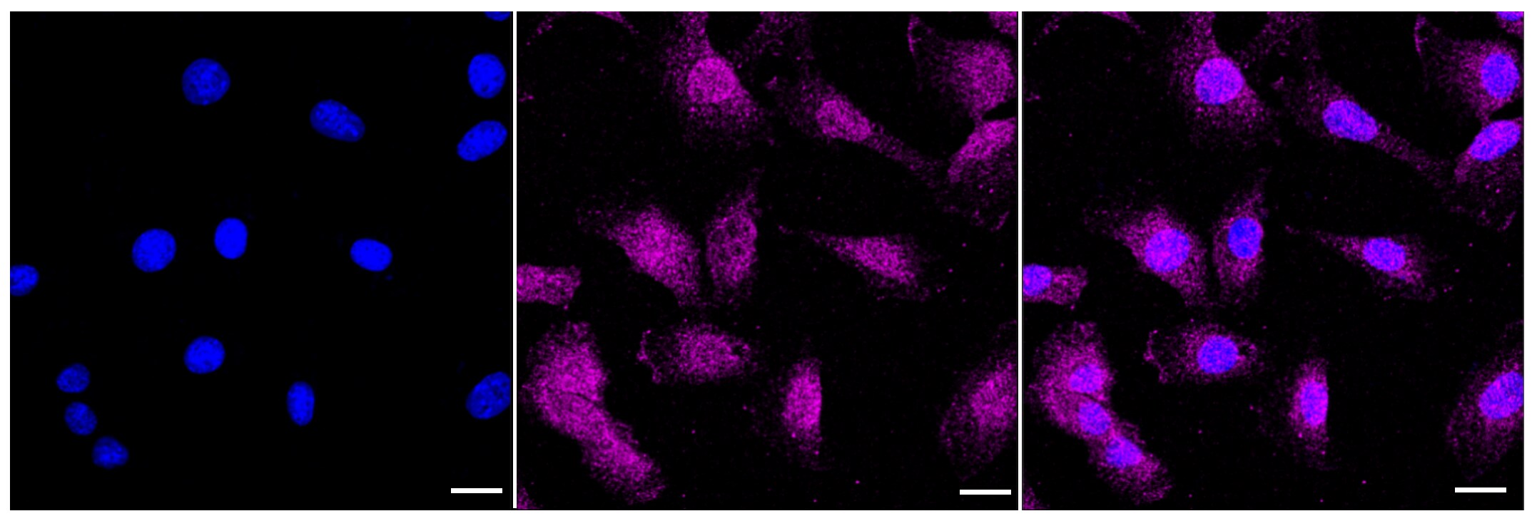 LC3A Antibody (23GB1960)