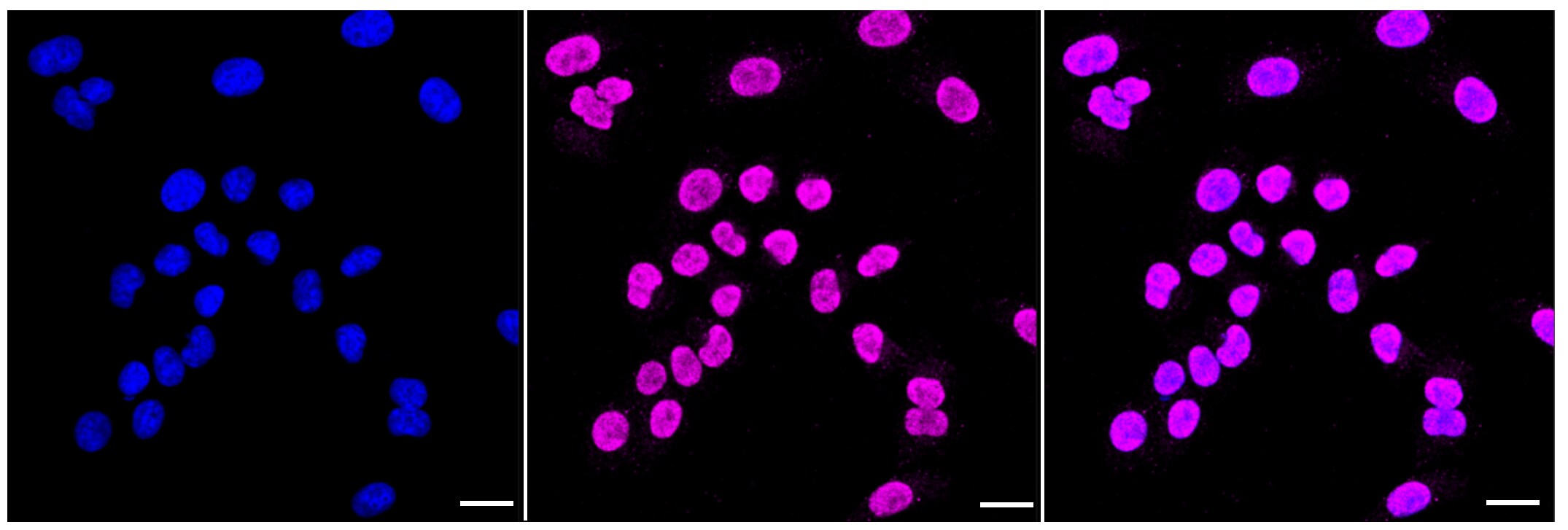 14-3-3 gamma Antibody (23GB1970)