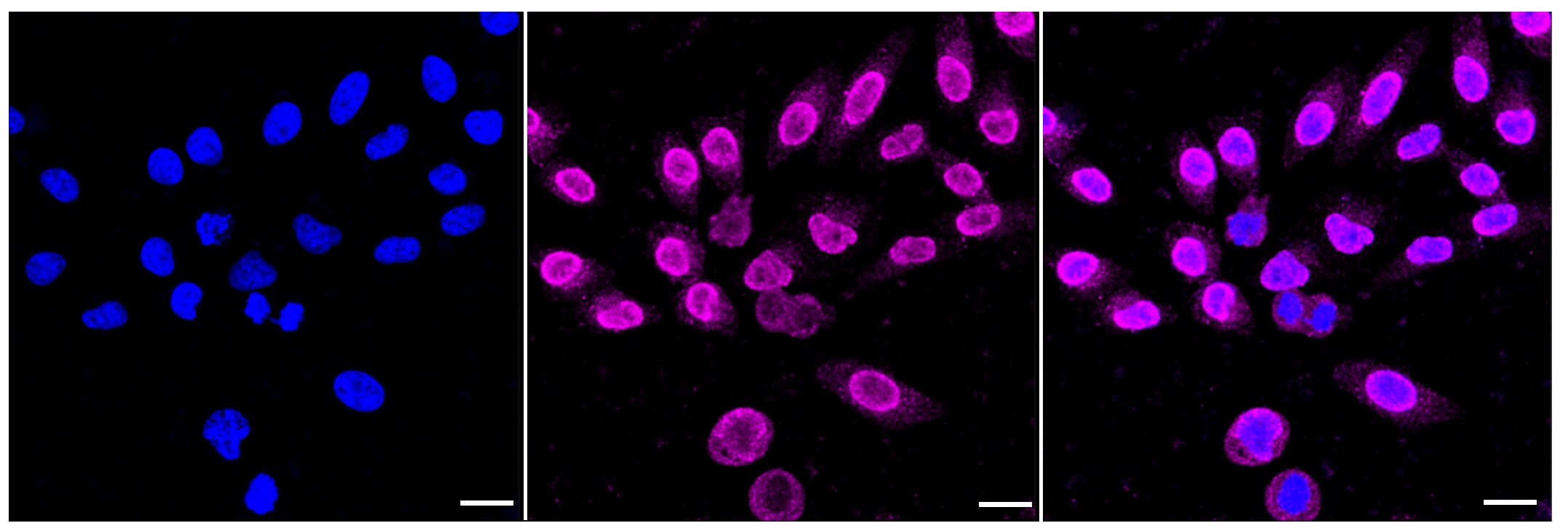 HSPB8/HSP22 Antibody (23GB1980)