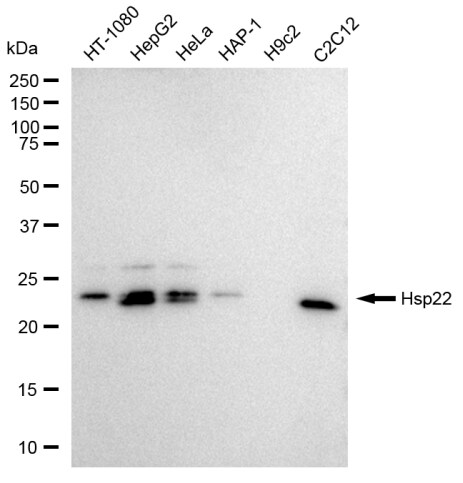 HSPB8/HSP22 Antibody (23GB1980)