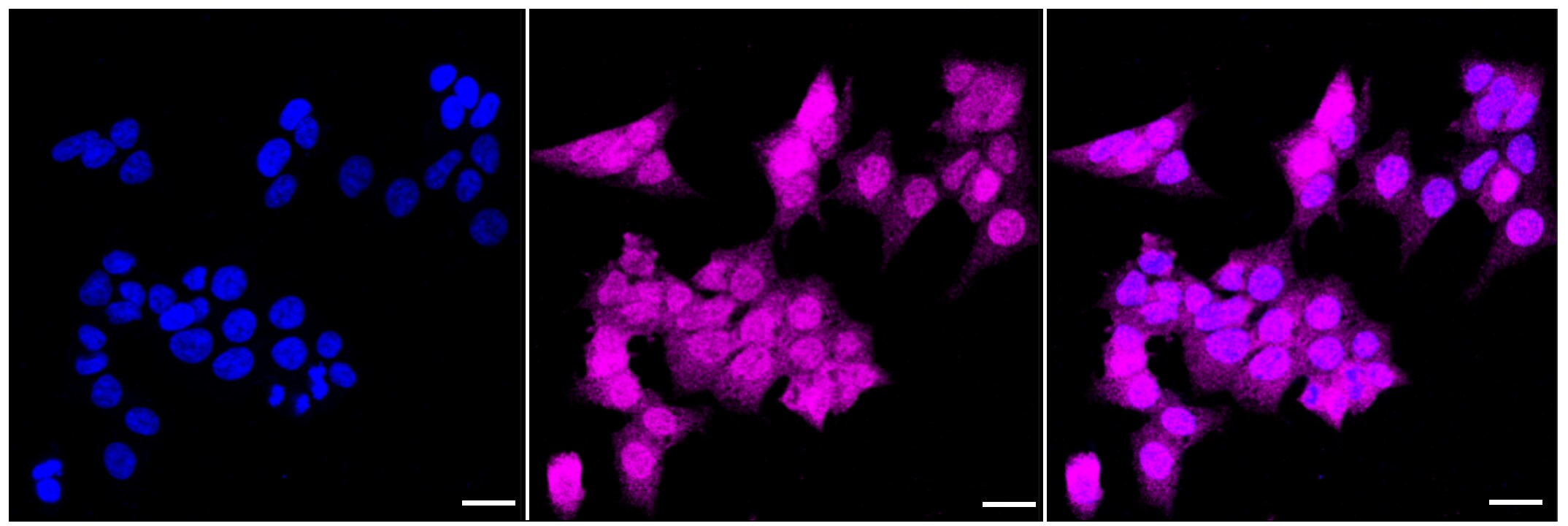 4EBP1 Antibody (23GB1985)