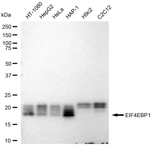 4EBP1 Antibody (23GB1985)