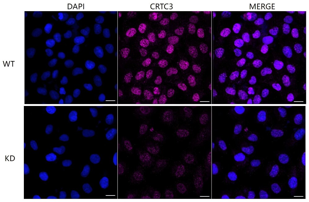 TORC3/CRTC3 Antibody (24GB5935)