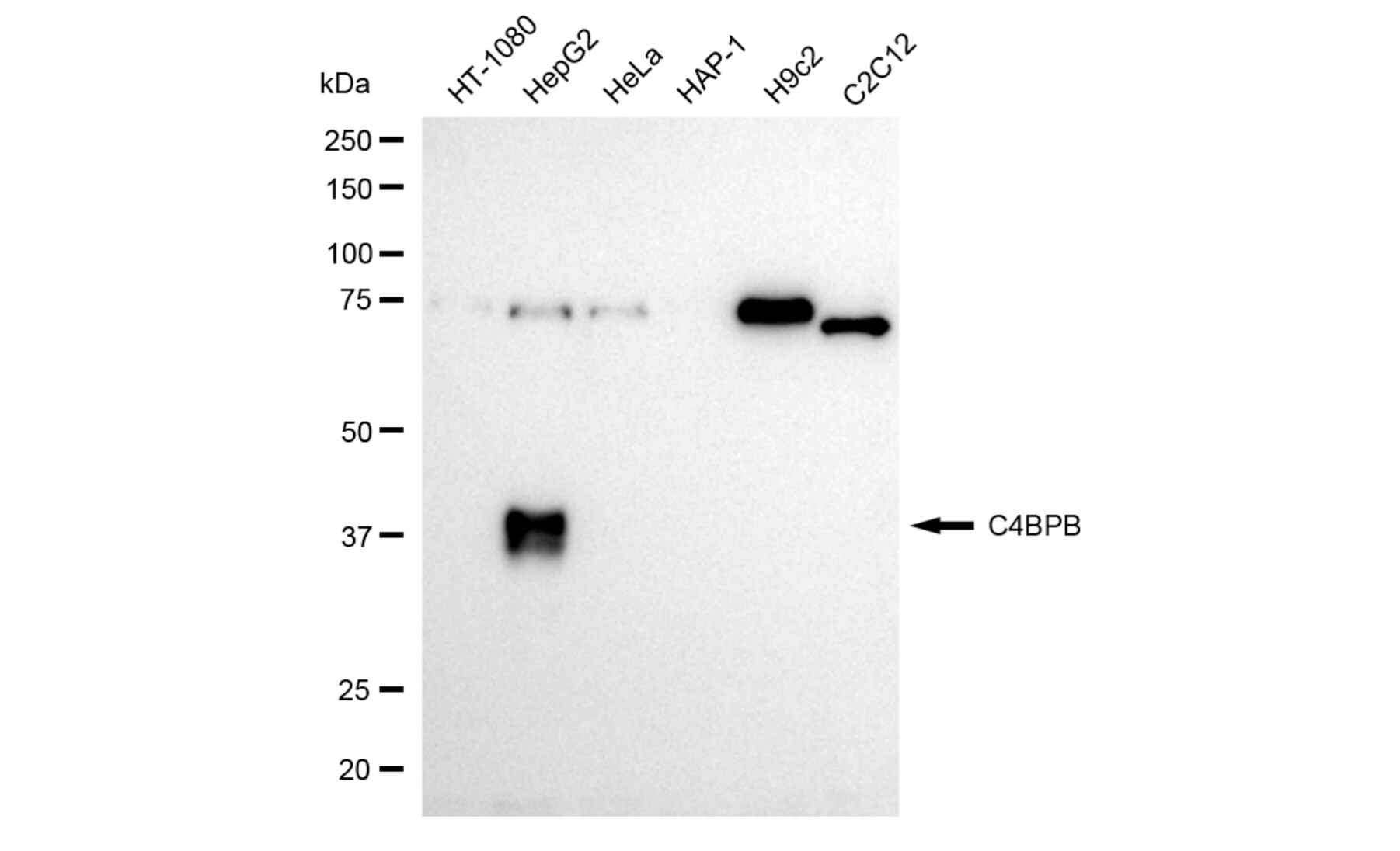 C4 binding protein B Antibody (24GB5940)