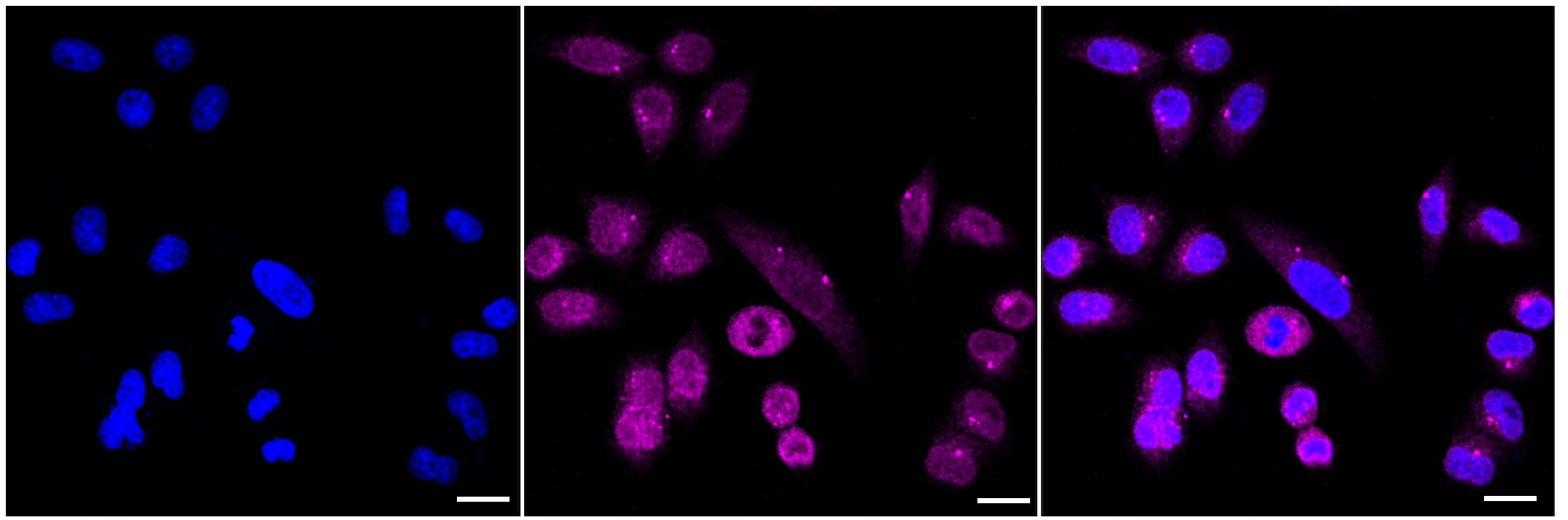 NUP155 Antibody (23GB2010)