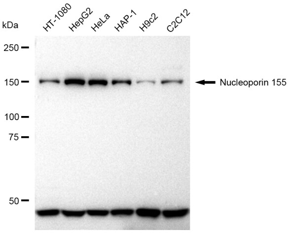 NUP155 Antibody (23GB2010)
