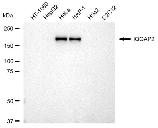 IQGAP2 Antibody (23GB2015)
