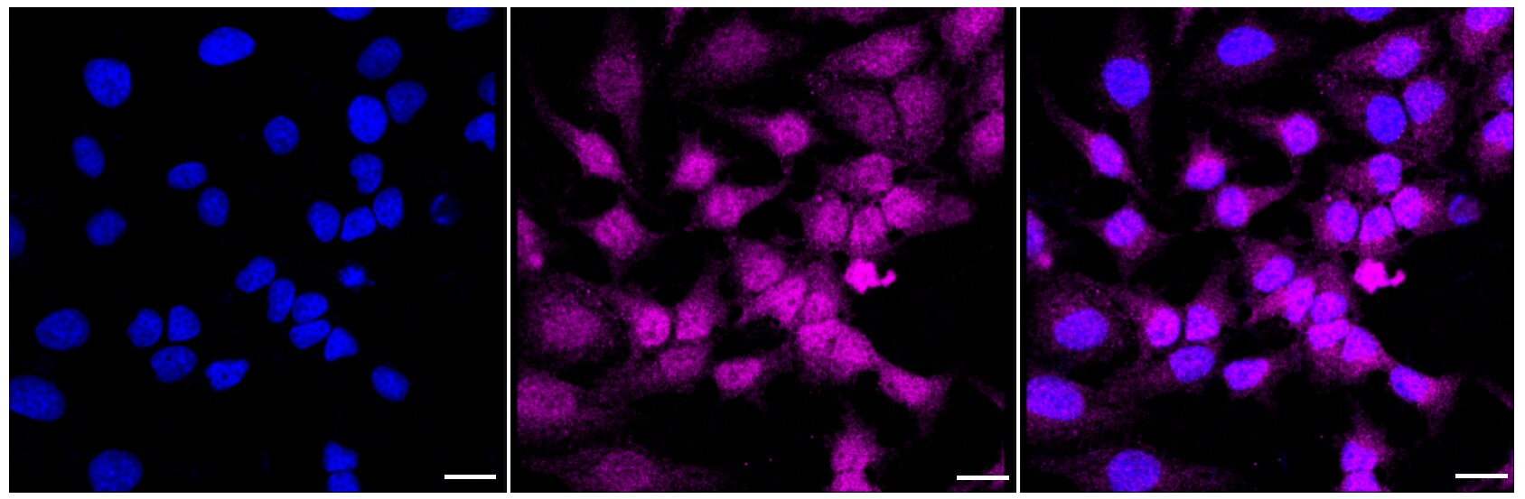 p18INK4c/CDKN2C Antibody (24GB5945)