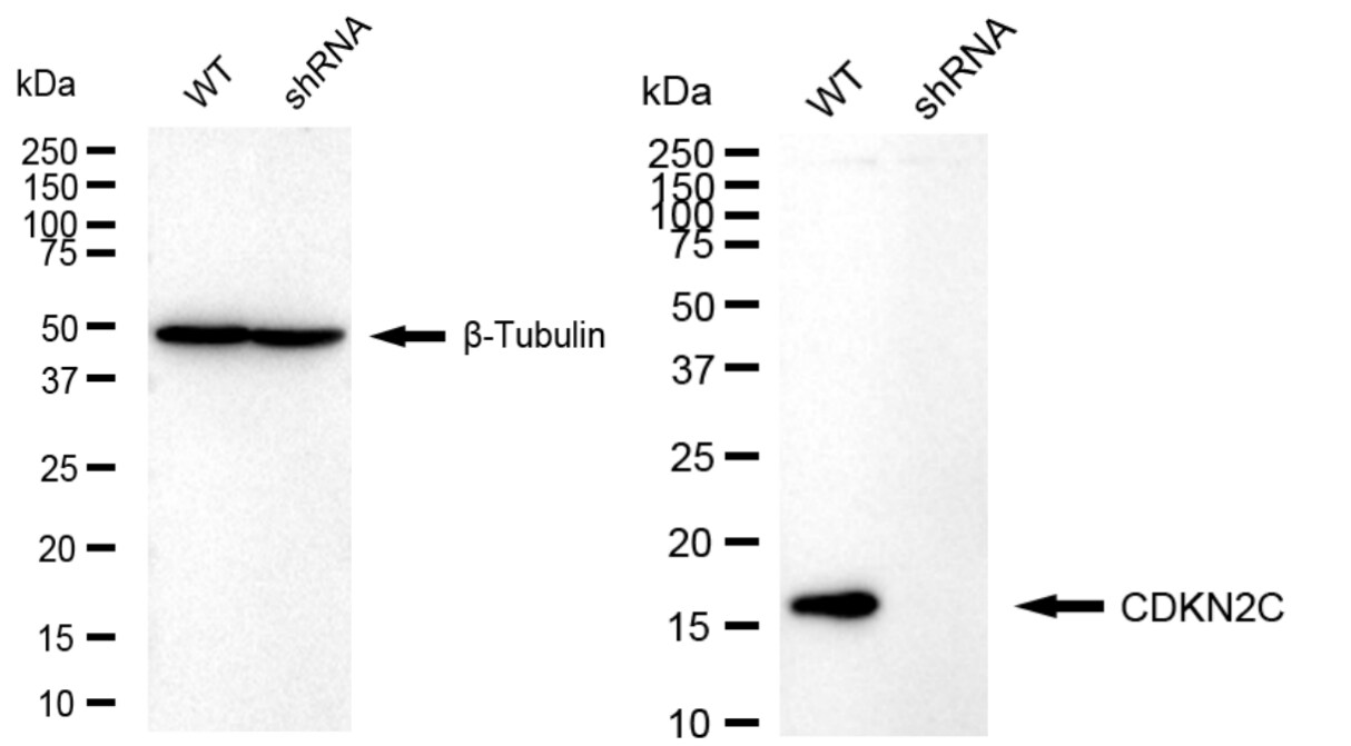 p18INK4c/CDKN2C Antibody (24GB5945)