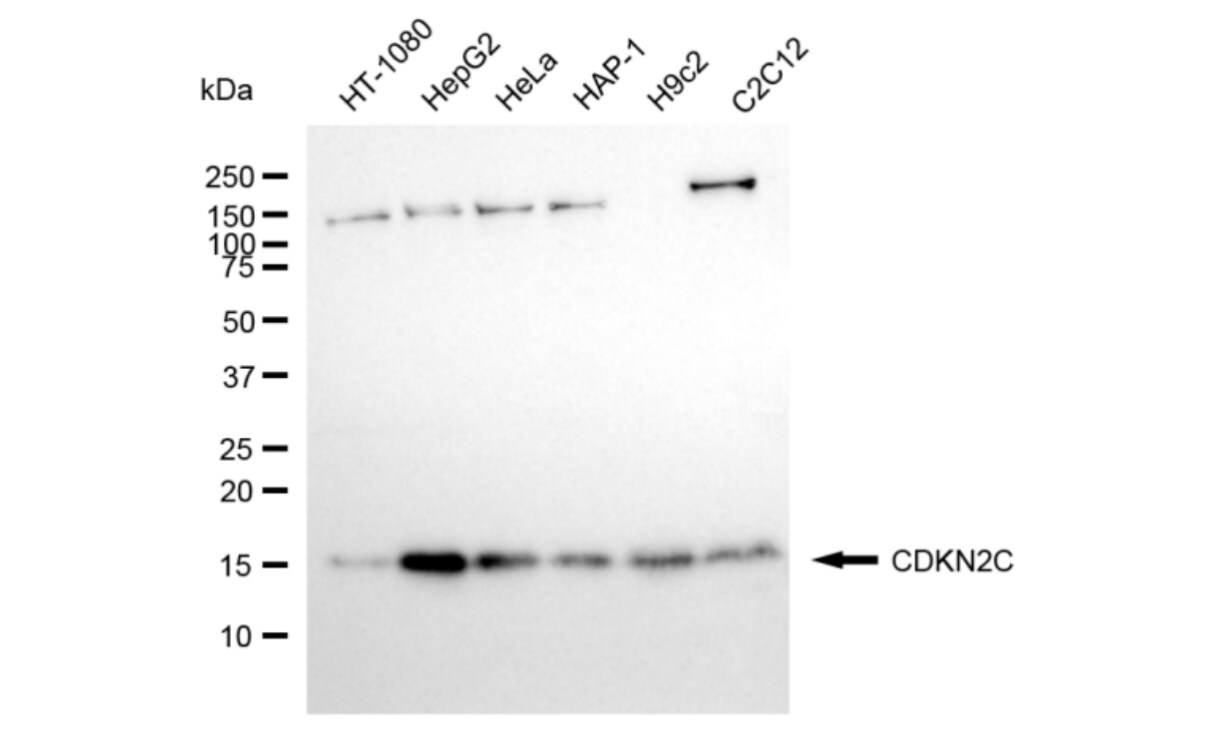 p18INK4c/CDKN2C Antibody (24GB5945)