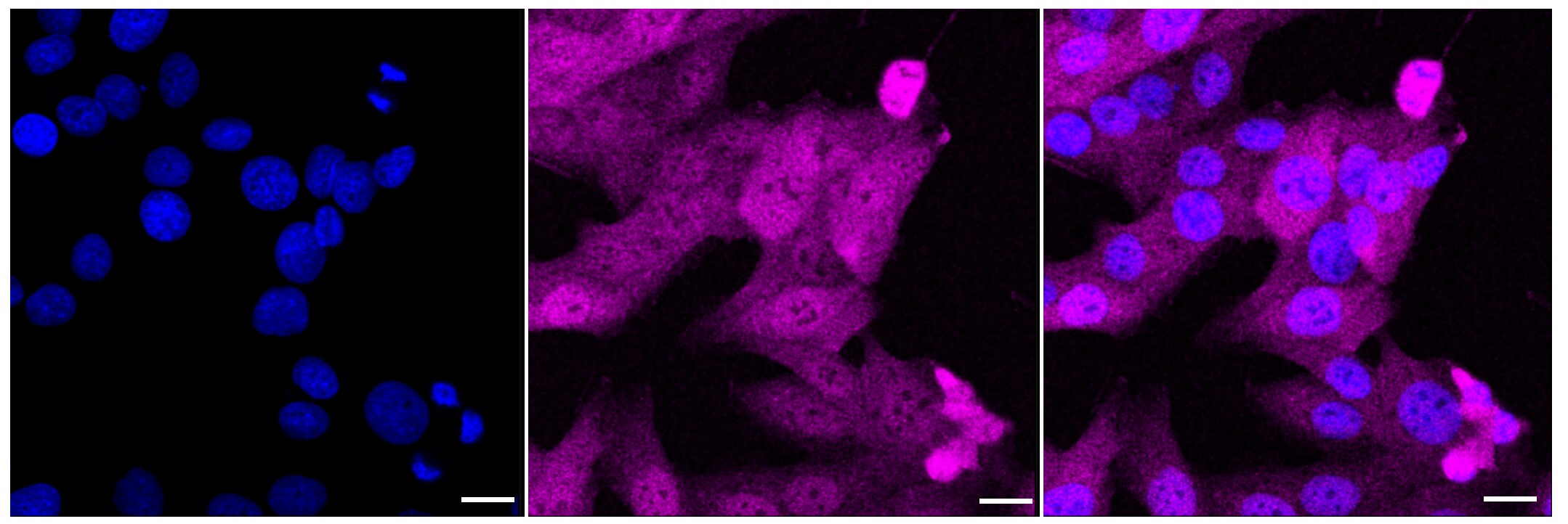 Bcl-10 Antibody (23GB1210)