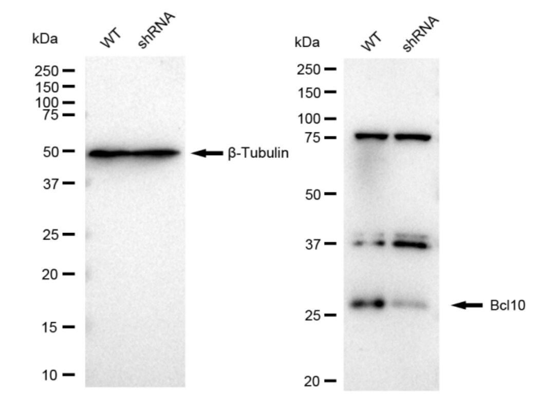 Bcl-10 Antibody (23GB1210)