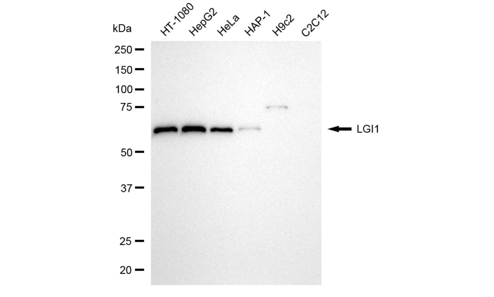 Lgi1 Antibody (24GB5950)