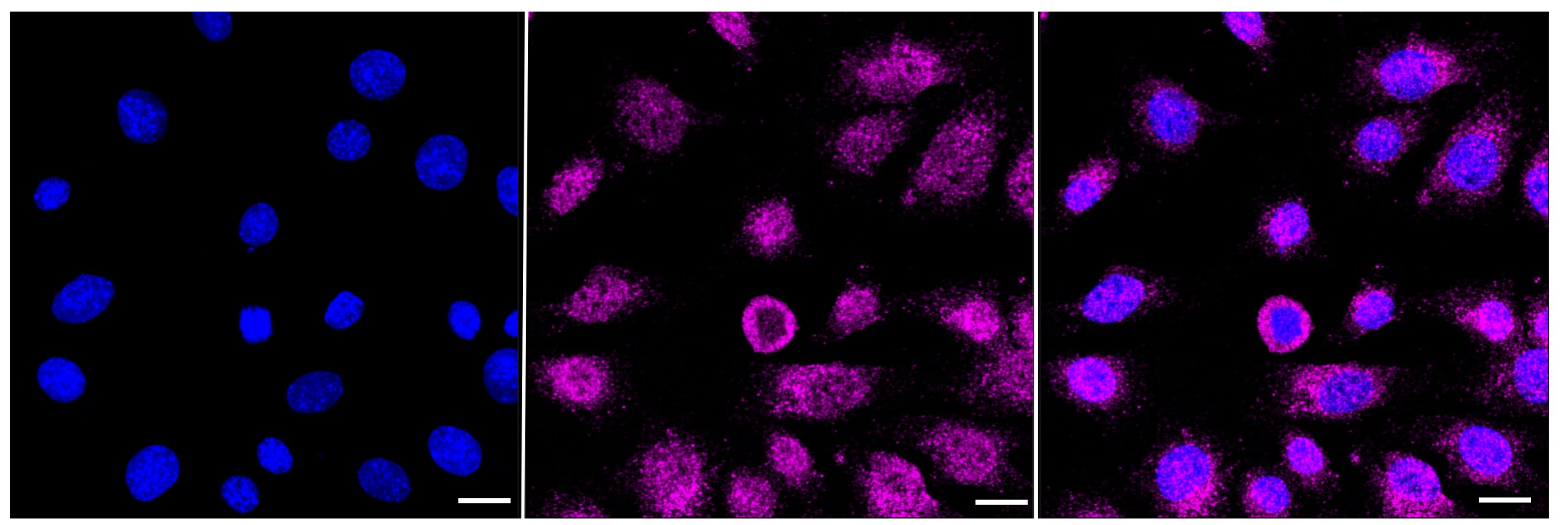 Calreticulin Antibody (23GB700)