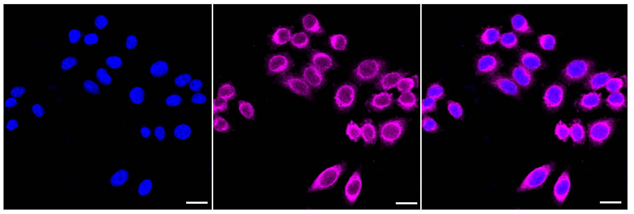 ROCK2 Antibody (23GB2030)