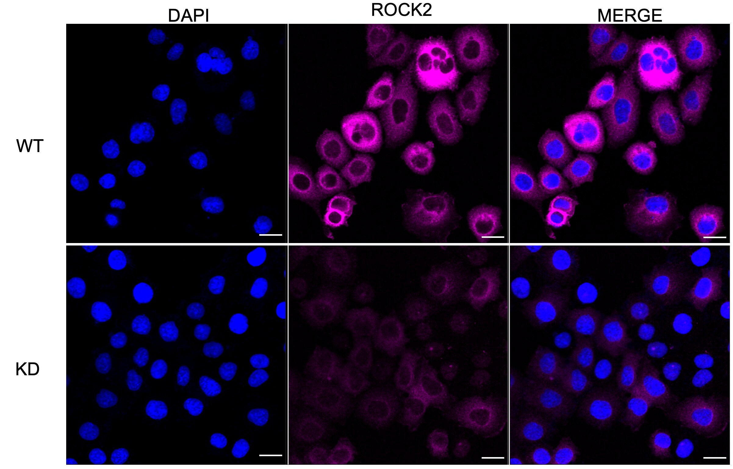 ROCK2 Antibody (23GB2030)