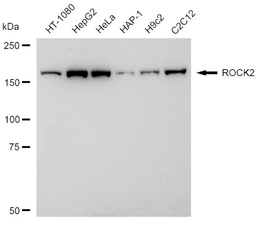 ROCK2 Antibody (23GB2030)