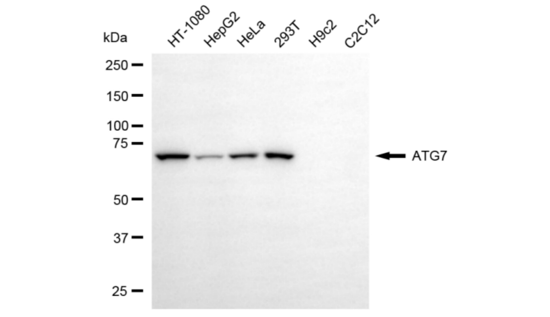 ATG7 Antibody (24GB5975)