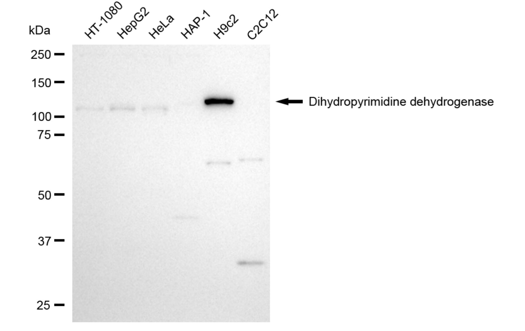 DPYD Antibody (24GB5990)