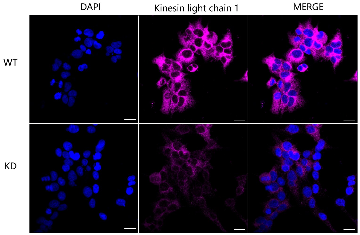 KLC1 Antibody (24GB6030)