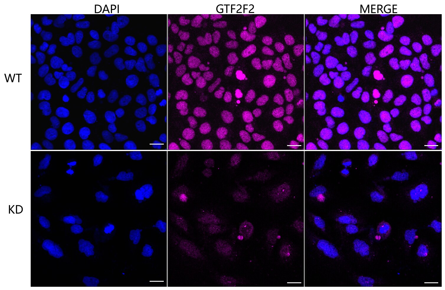 RAP30 Antibody (24GB6035)