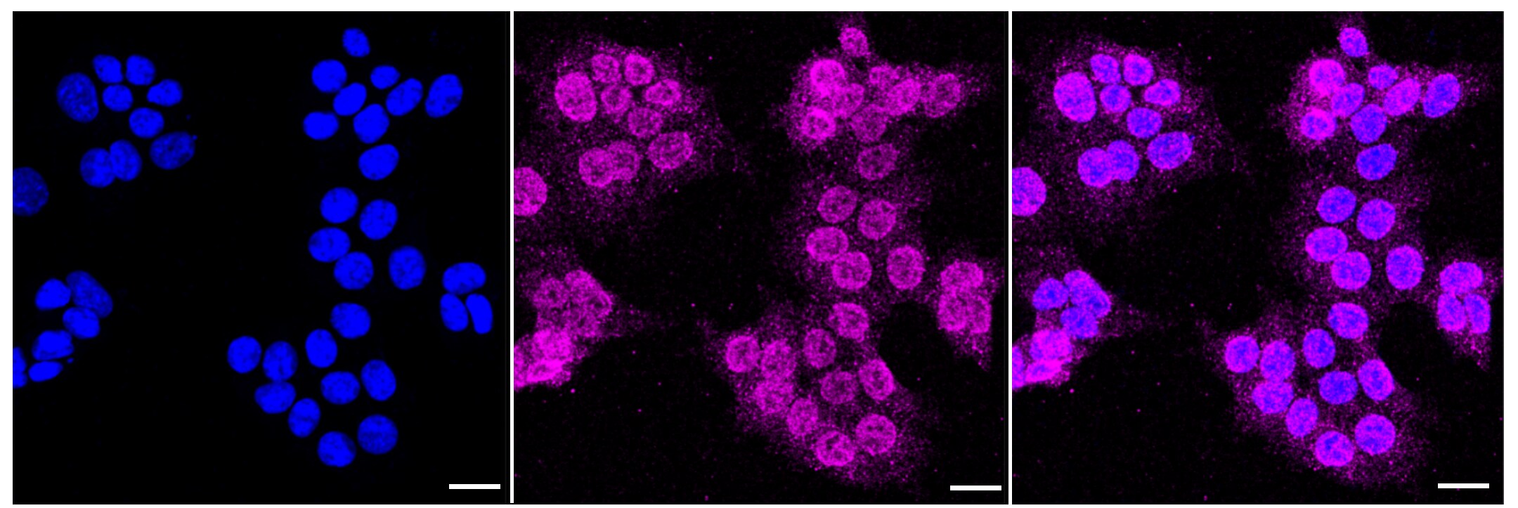 Mer Antibody (23GB2070)