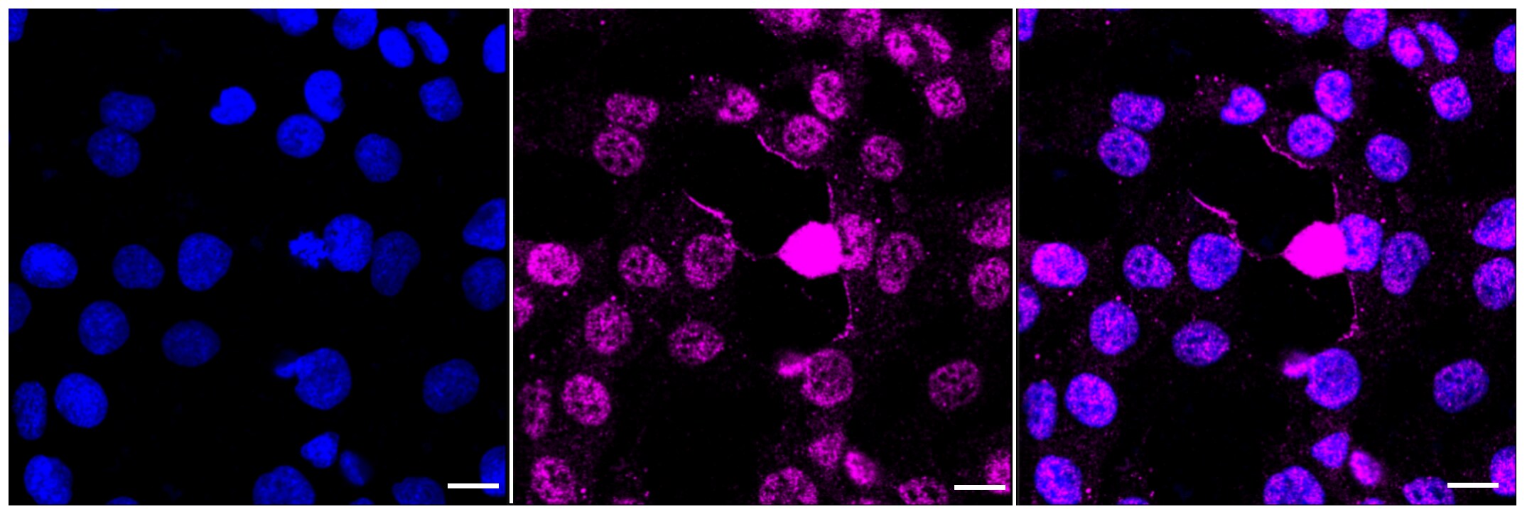 DNA-PKcs [p Ser2056] Antibody (23GB2075)