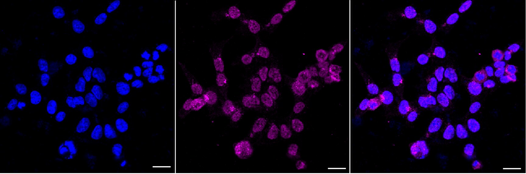 HLA Class I Antibody (24GB6040)