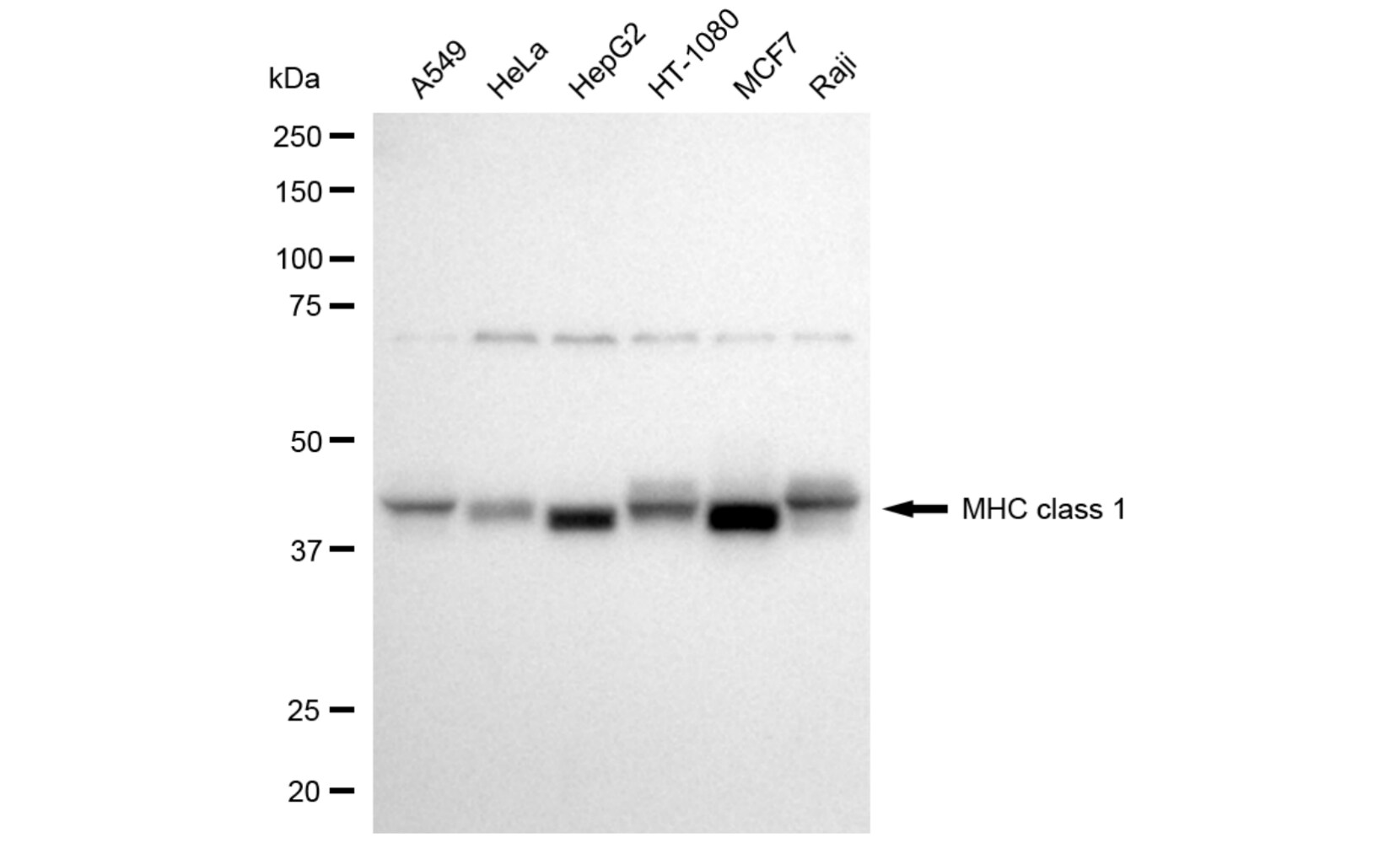 HLA Class I Antibody (24GB6040)