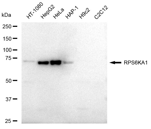 RSK1 Antibody (23GB2080)