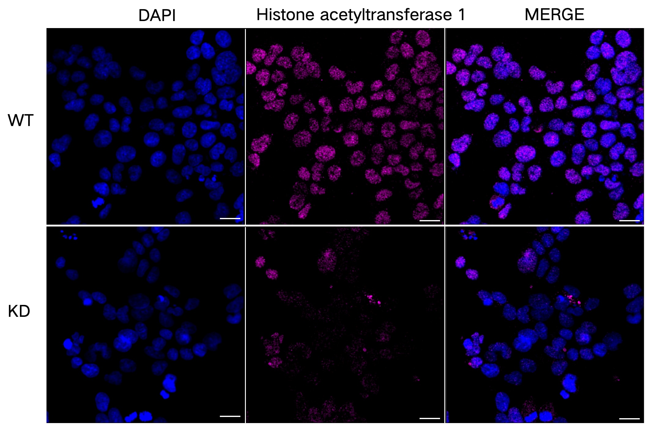 KAT1 Antibody (23GB2090)