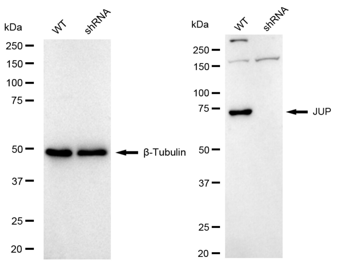 gamma Catenin Antibody (24GB6055)