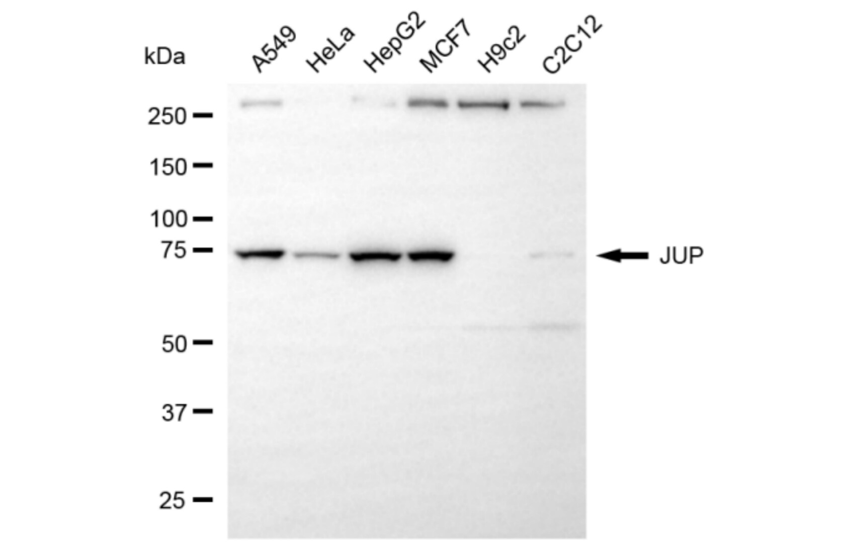 gamma Catenin Antibody (24GB6055)