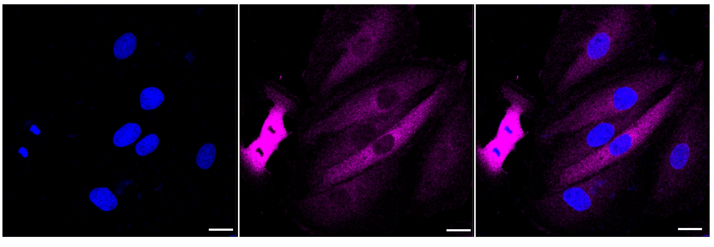AlphaB Crystallin/CRYAB Antibody (24GB6070)