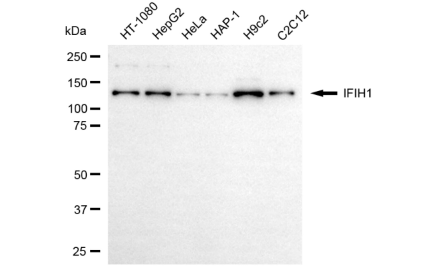 MDA5 Antibody (24GB6085)