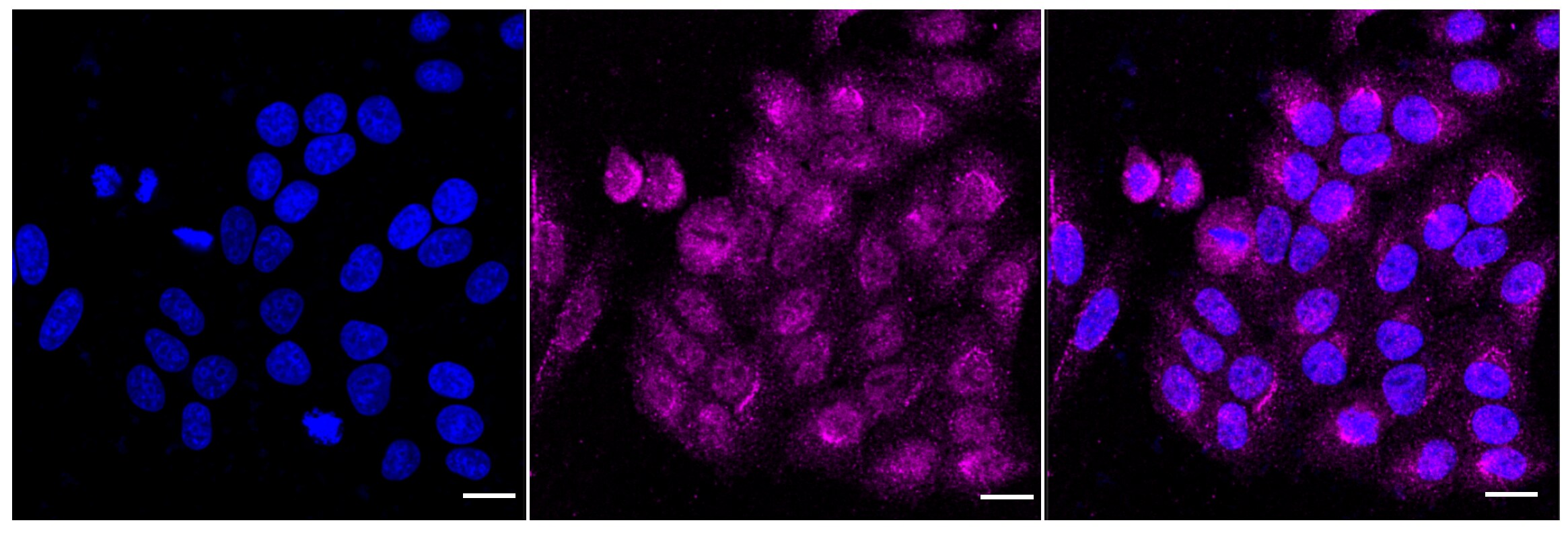 GLI-3 Antibody (24GB6105)