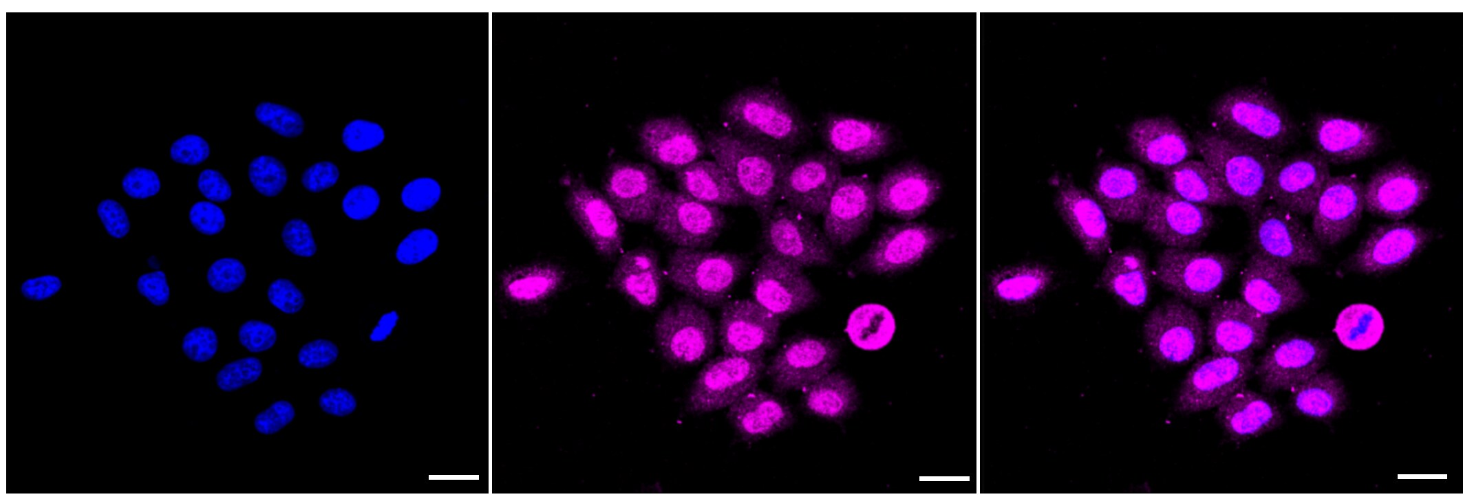 Peroxiredoxin 1 Antibody (23GB2120)