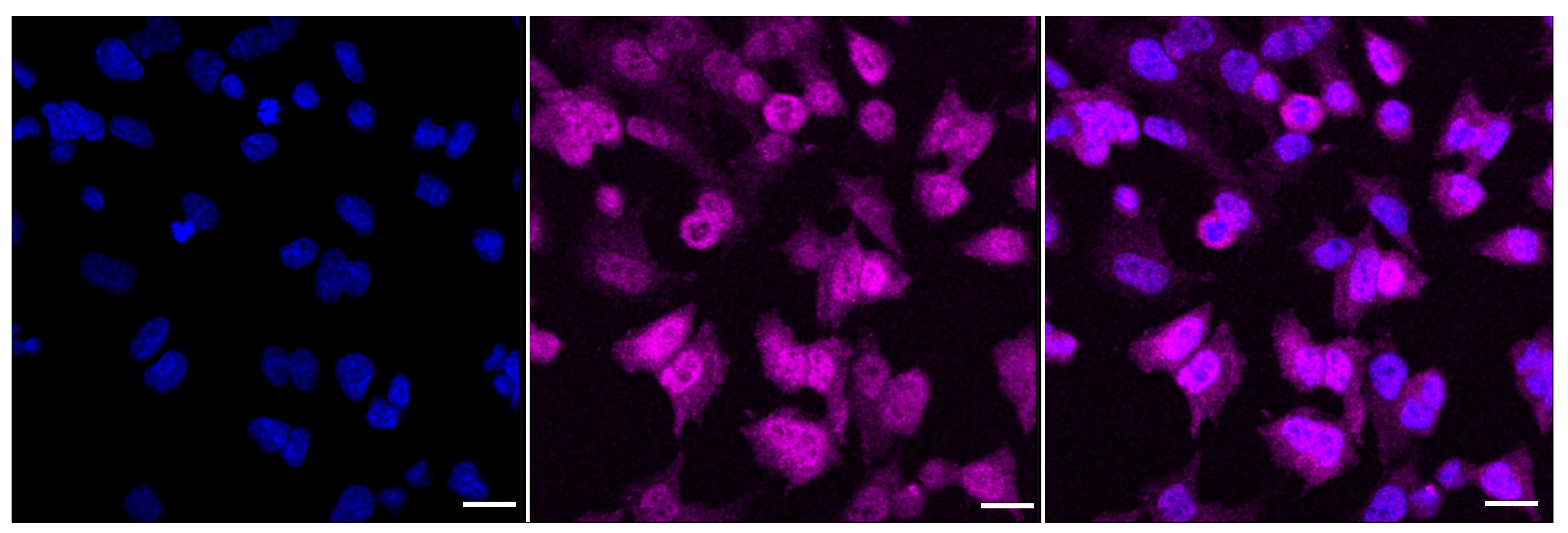 Galectin-3 Antibody (23GB2130)